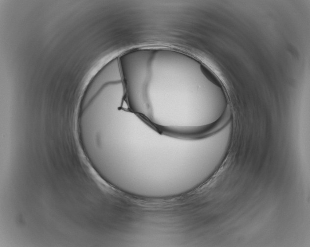 X0000114581485200910191044