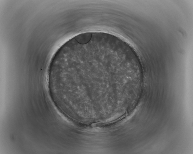 X0000114581517200911091225