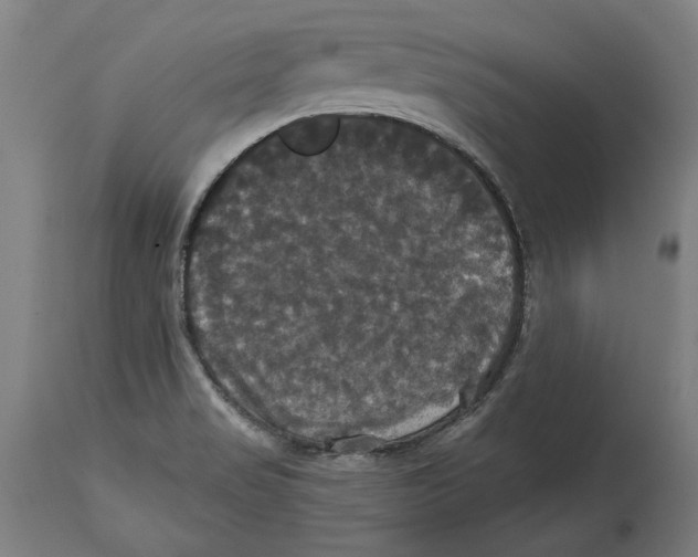 X0000114581517200911161257