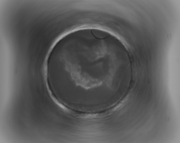 X0000114591519200910191547