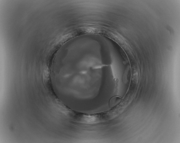 X0000114590469200911091300