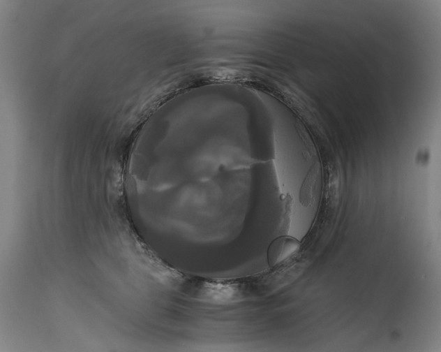 X0000114590469200911161335