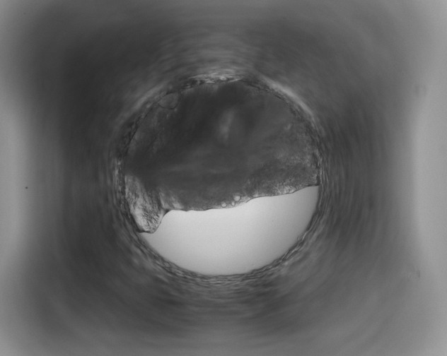 X0000114601399200910191045