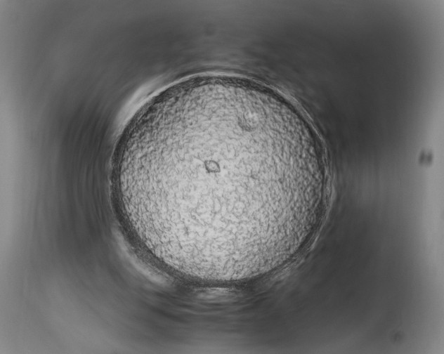 X0000114600151200911161403