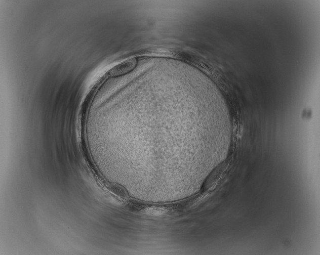 X0000114600294200911161401