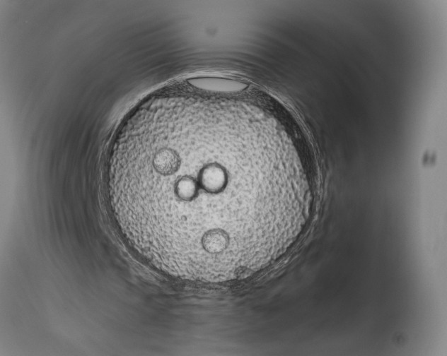 X0000114600337200911161400