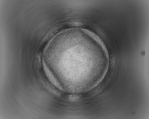 X0000114600373200911161400