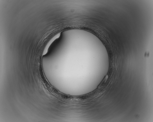 X0000114600599200911161356