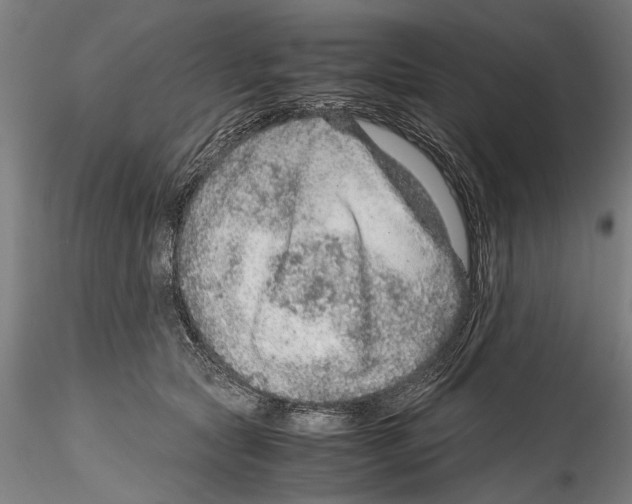 X0000114600561200911301425