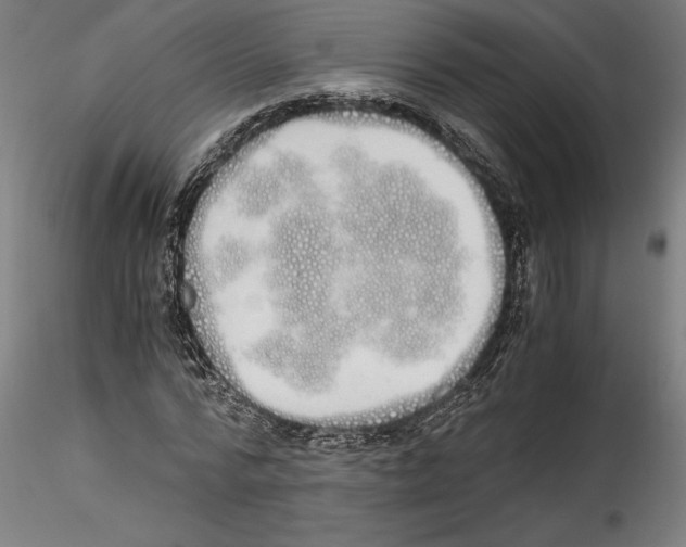 X0000114600776200911301422