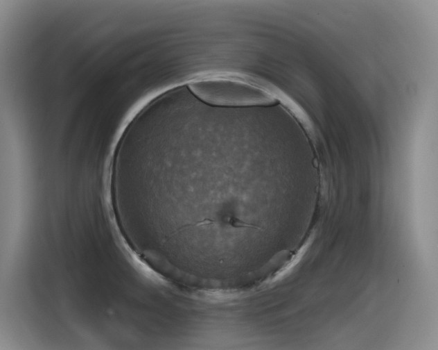 X0000114611102200910201147