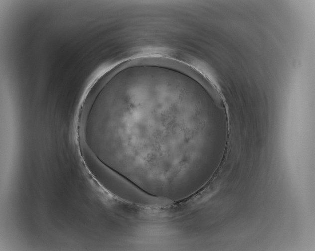 X0000114611104200910201147