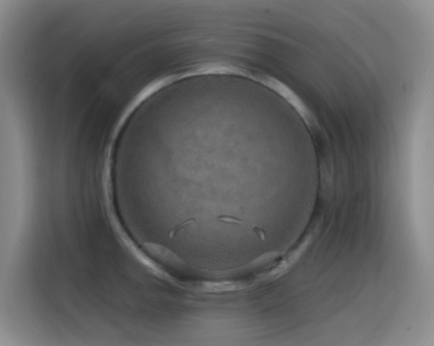 X0000114611142200910201147