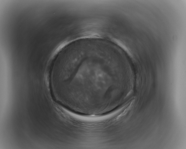 X0000114611455200910201143