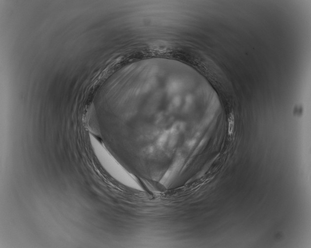 X0000114611011200911101147