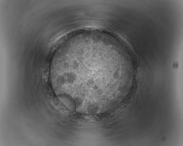 X0000114611015200911101147