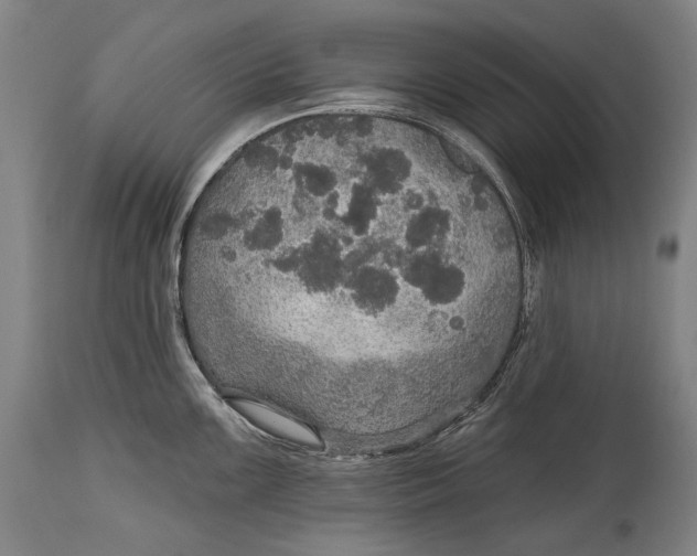 X0000114611099200911101146