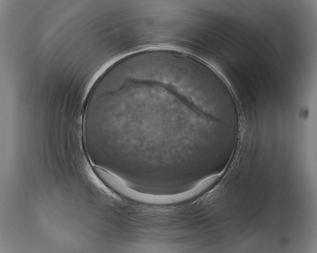 X0000114611100200911101146