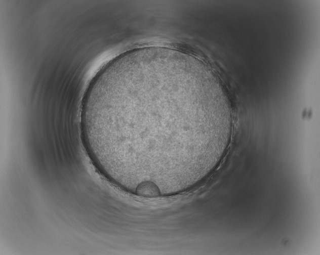 X0000114610006200911171045