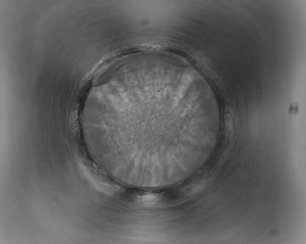 X0000114610312200911171041