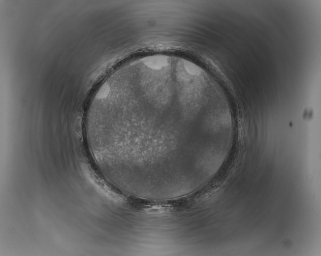 X0000114610447200911171038