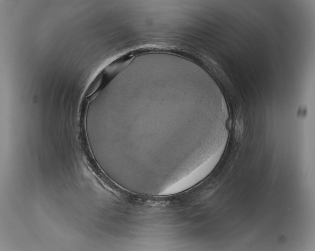 X0000114610484200911171038