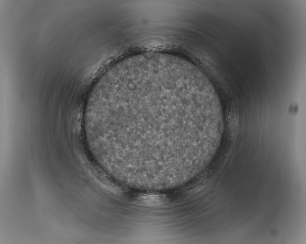 X0000114610499200911171038