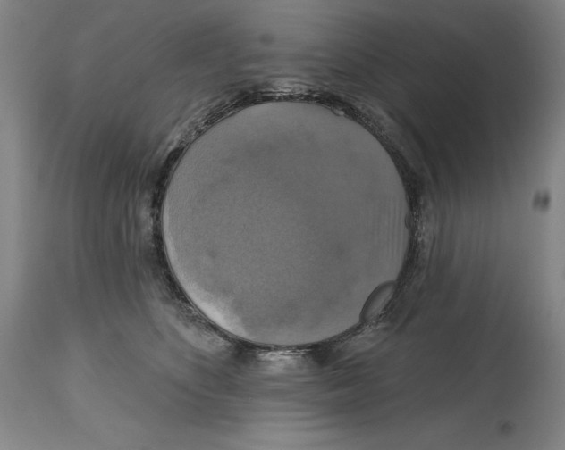 X0000114610516200911171038