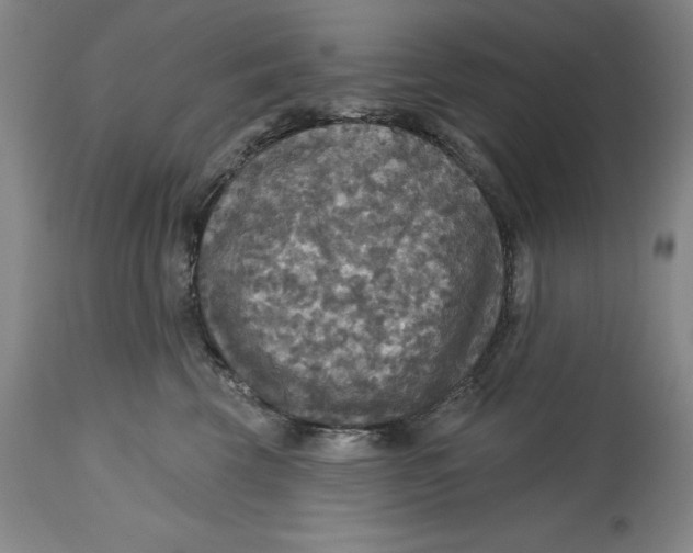 X0000114610569200911171038