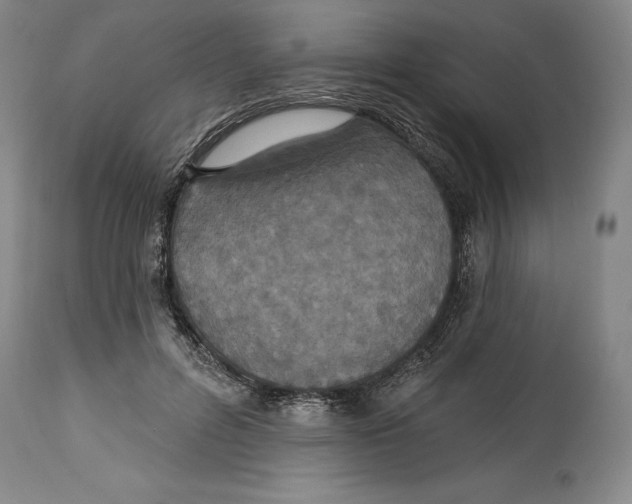 X0000114610600200911171036