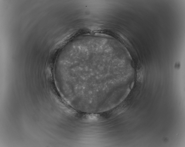 X0000114610618200911171036