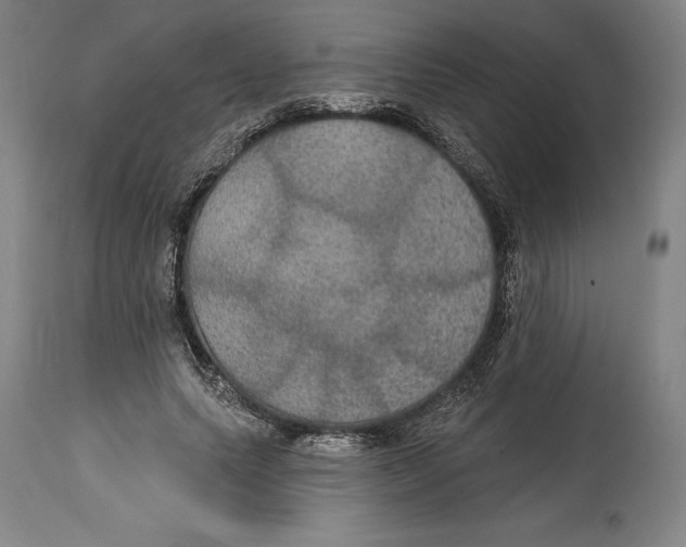 X0000114610639200911171036