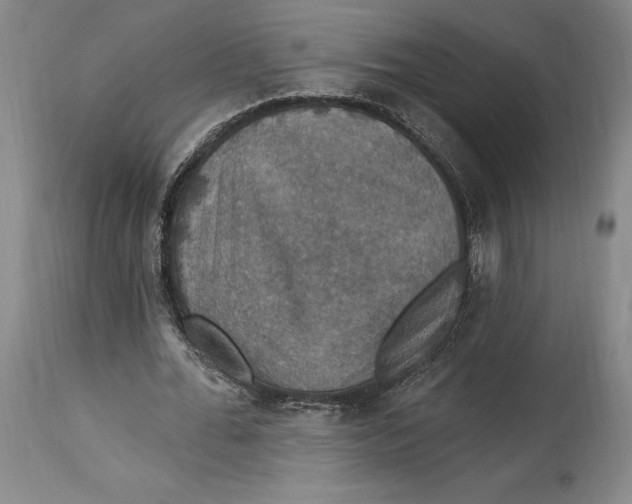 X0000114610676200911171035