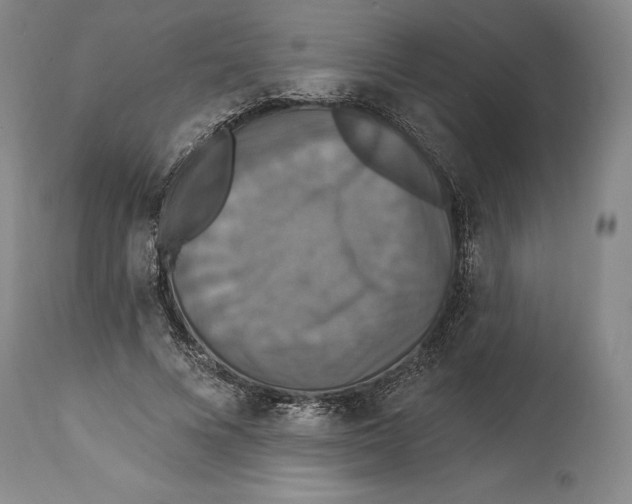 X0000114610688200911171035