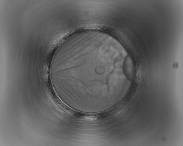 X0000114610692200911171035