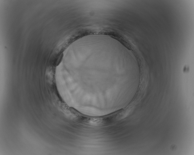 X0000114610720200911171035