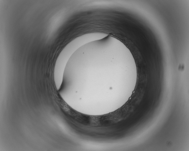 X0000114610766200911171035