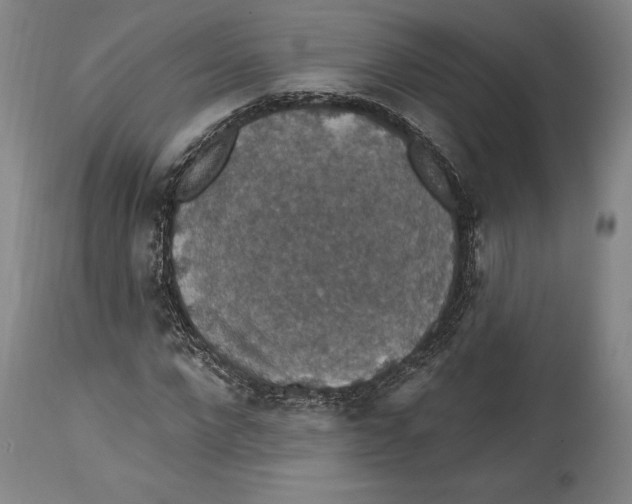 X0000114610872200911171033