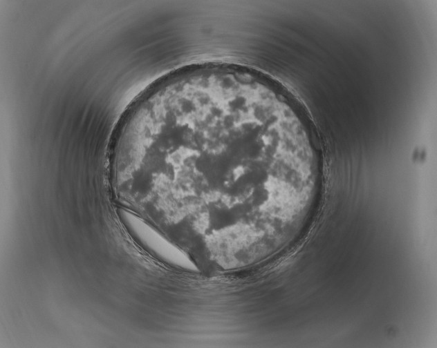 X0000114610879200911171032