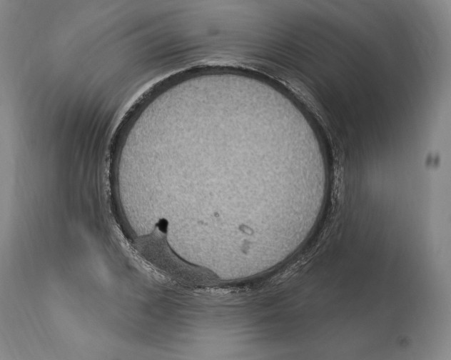 X0000114610976200911171031