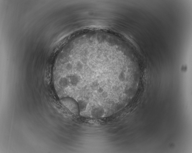 X0000114611015200911171030