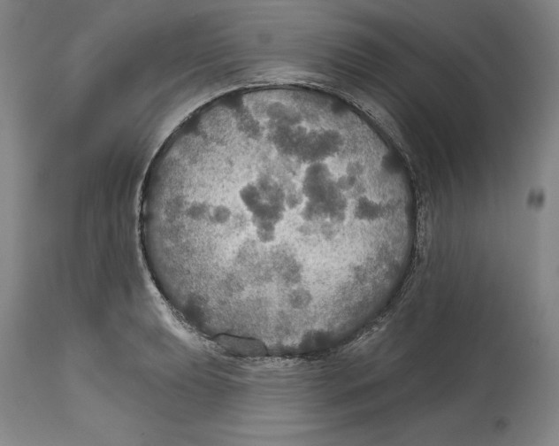 X0000114611039200911171030