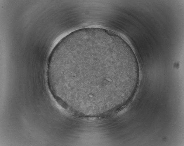 X0000114611149200911171029