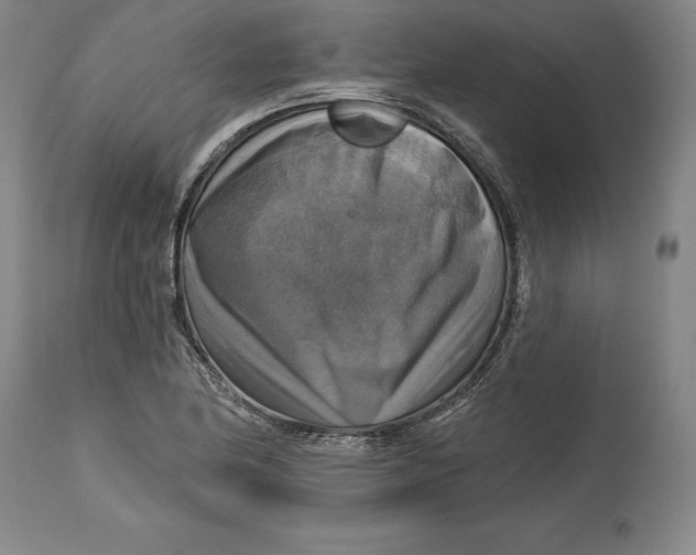 X0000114611174200911171028