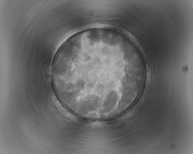 X0000114611178200911171028