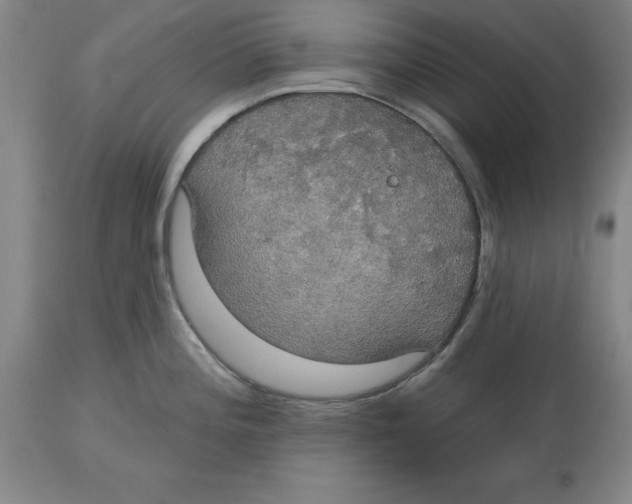 X0000114611196200911171028