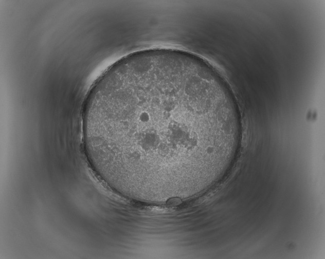 X0000114611271200911171027