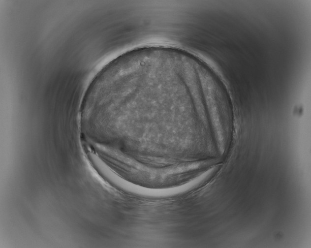 X0000114611335200911171026