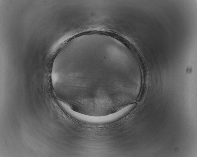 X0000114611359200911171025