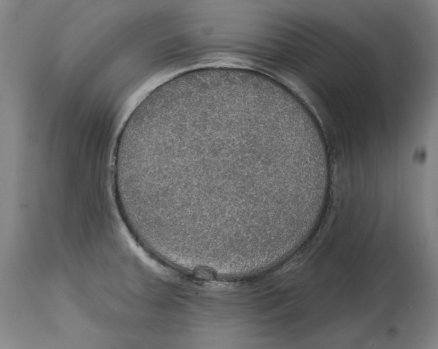 X0000114611379200911171025